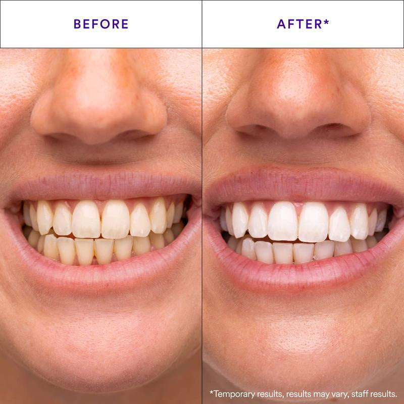 Smile Teeth Strips Teeth Cleaning Care Whitening Strips